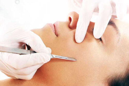 Spa Bella Medispa - Denver, CO | Denver dermaplaning