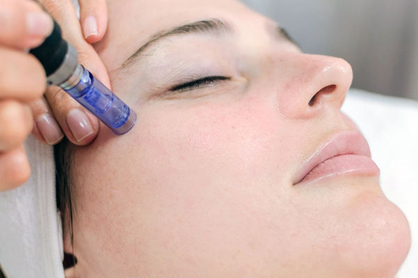 Denver Skin Care Clinic and Medical Spa microneedling microneedling