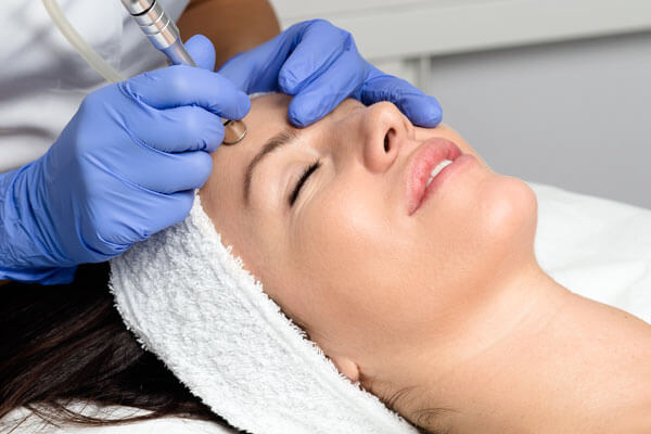 Microdermabrasion