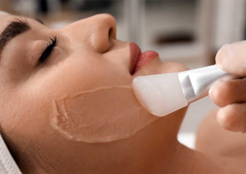 Woman getting chemical peel