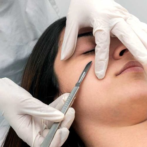 Woman getting dermaplaning treatment