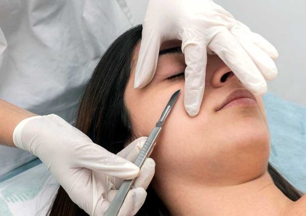 Woman getting dermaplaning treatment