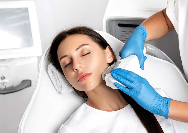 IPL/BBL Photofacial