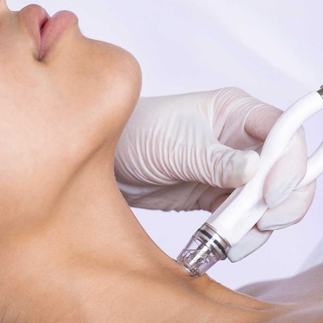 Woman get DiamondGlow treatment on her neck