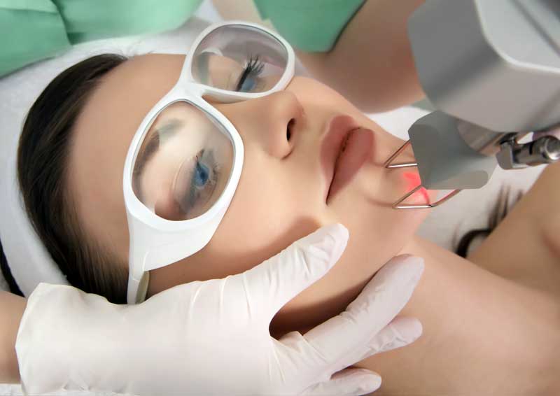 co2-laser-skin-treatment Woman getting BOTOX